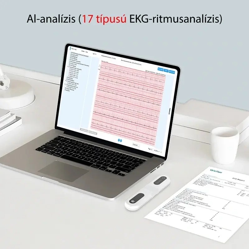 viatom-er1-lw-24-oras-ekg-holter-rogzito-mobil-ekg-holter-ai-analizis